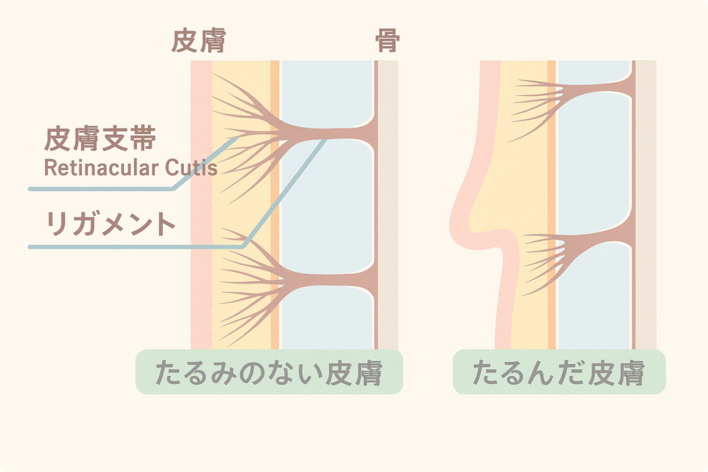 ジャルプロとは