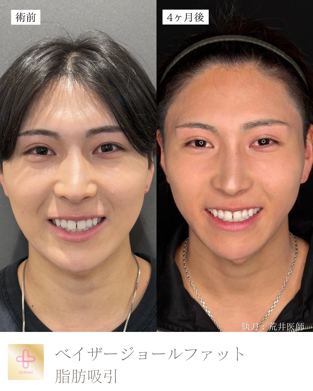 ジョールファット