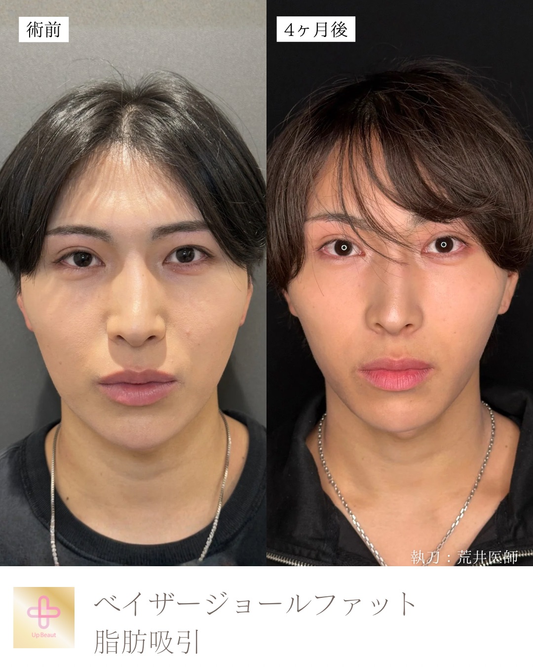 ジョールファット