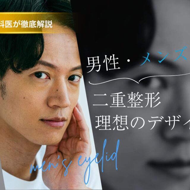 メンズ　二重整形