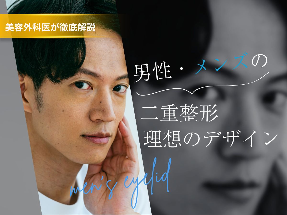 メンズ　二重整形