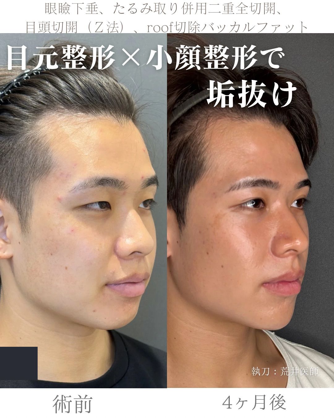 全顔整形症例